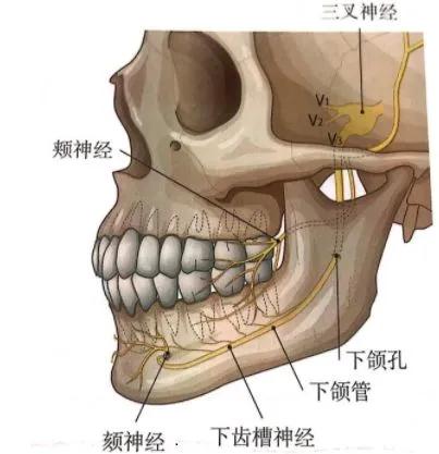 下颌角手术中决定曲线美的要素有哪些？